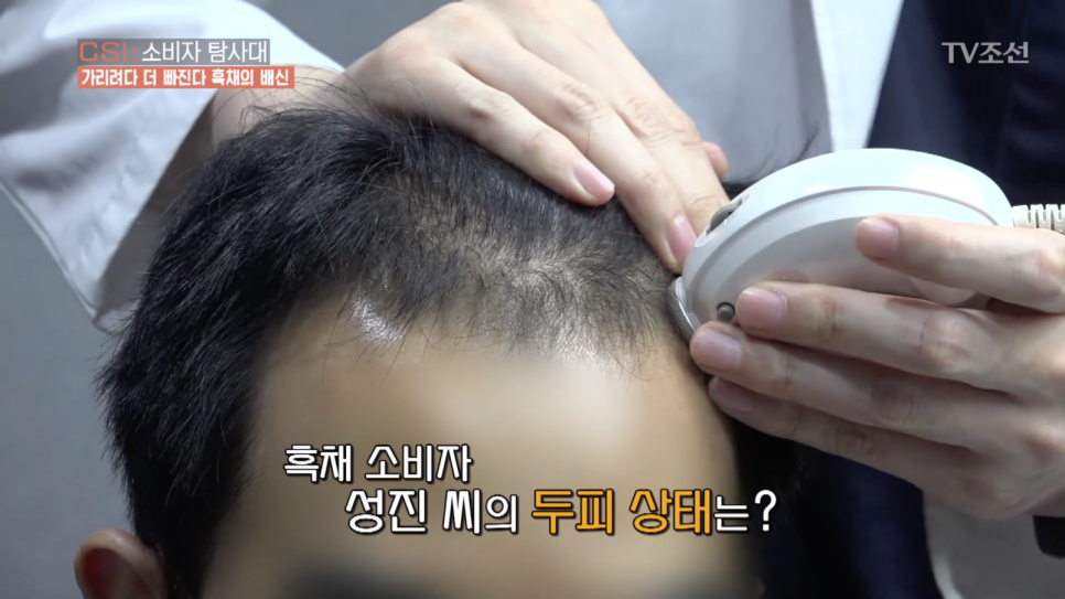 TV조선 <CSI:소비자탐사대> "흑채의 배신" 인터뷰 진행 관련 이미지 3