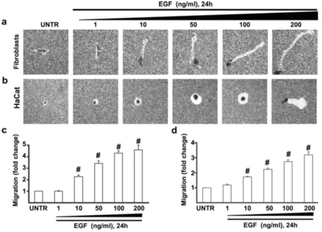 아테미스 Artemes 여신주사의 비밀 관련 이미지 5