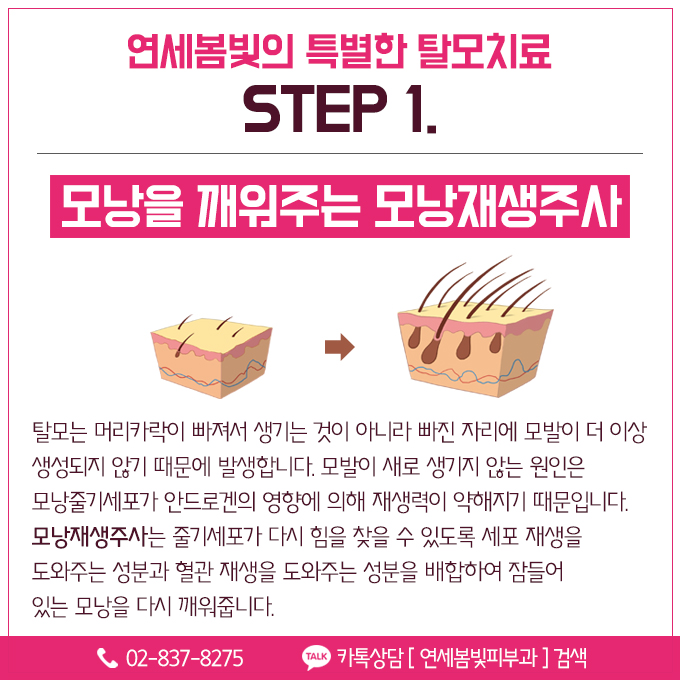 여성형 탈모는 무엇일까요? 관련 이미지 4