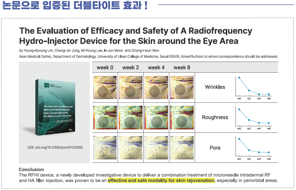 더블타이트 (Double Tite) 도입 안내 관련 이미지 8