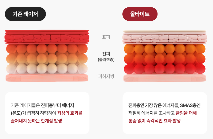 통증 적고 즉각적인 전층 콜라겐 리프팅, 올타이트를 소개합니다. 관련 이미지 4