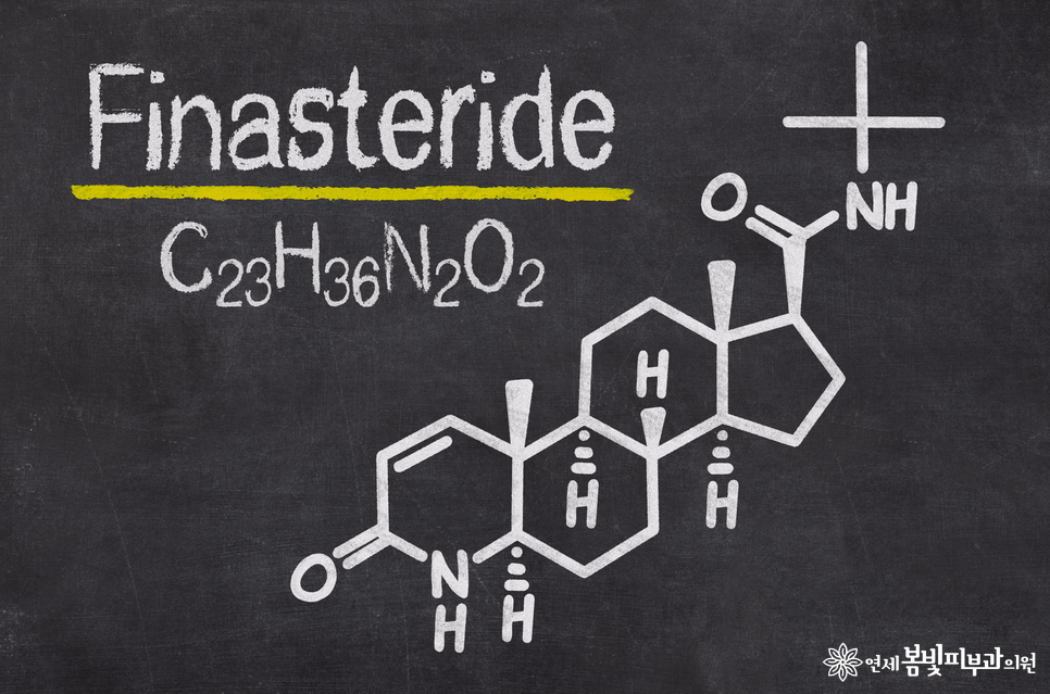 프로페시아와 같은 성분이라는 프로스카, 탈모치료에 사용해도 괜찮을까요? 관련 이미지 3