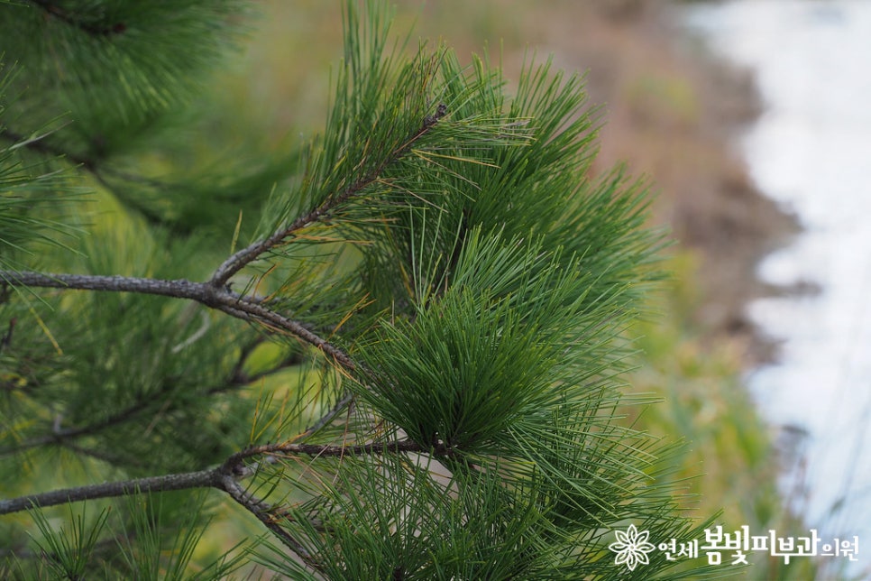 봄철에 발생하는 나무 꽃가루 알레르기 (알러지피부염, 아토피피부염, 천식) 관련 이미지 5