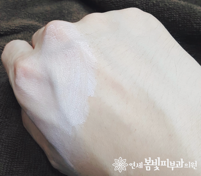 여드름, 지성 피부에도 문제없는 ASF 피지컬 선블럭 관련 이미지 9