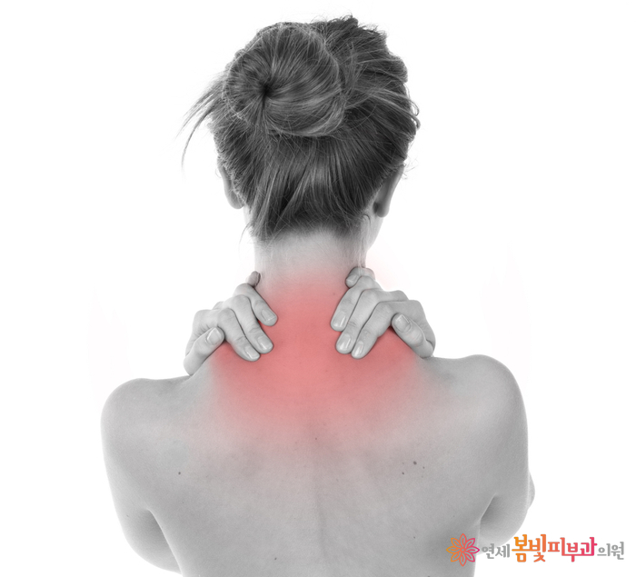 보톡스 바르게 알기 #3 (보톡스 맞고 예뻐지기, 보톡스 시술이 가능한 부위, 이마 주름, 미간 주름, 눈가 주름, 눈밑 주름, 콧잔등 주름, 입가 주름, 사각턱, 종아리, 윤곽술 관련 이미지 8