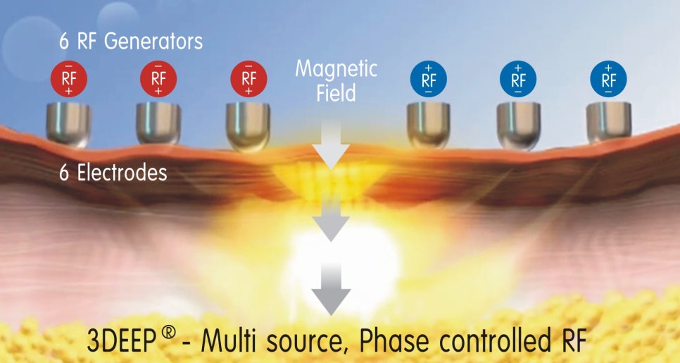 엔디메드 3DEEP Pure+ 2.0 도입 안내 관련 이미지 3