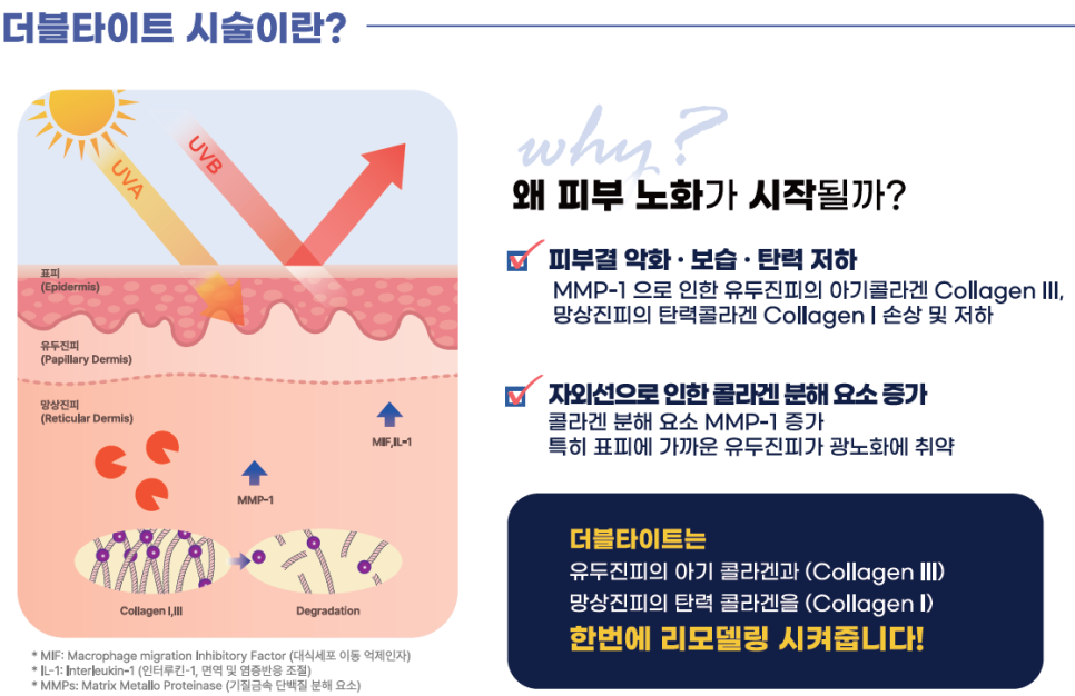 더블타이트 (Double Tite) 도입 안내 관련 이미지 2