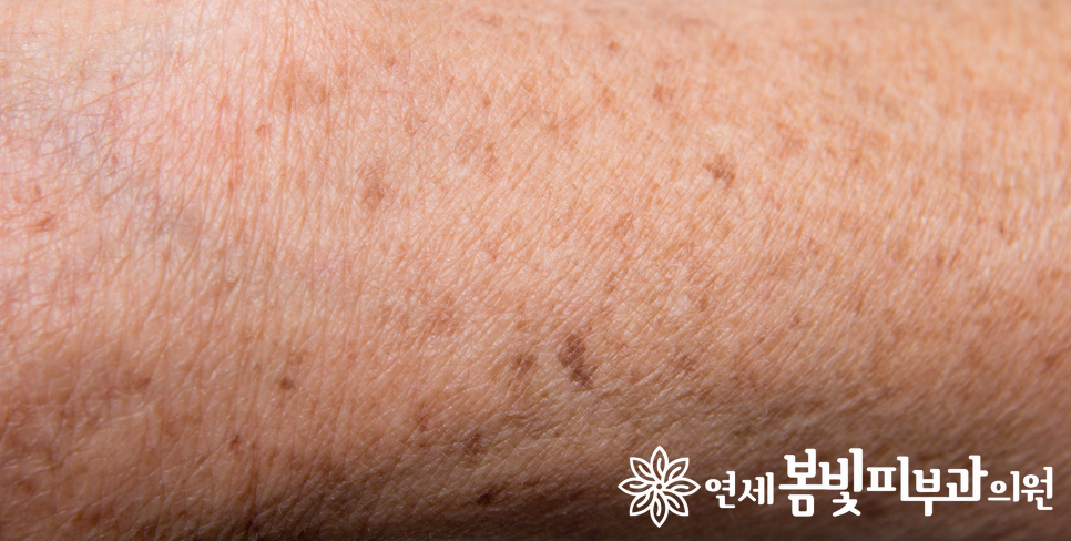 건강미를 과시하는 태닝, 괜찮을까요? 관련 이미지 7