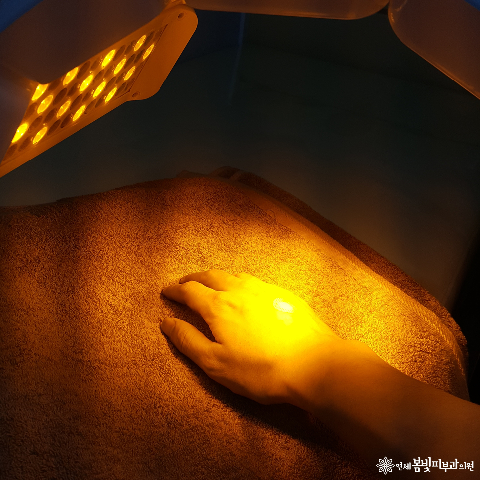 화상, 화상치료, 화상흉터치료 잘 하는 법 (화상병원, 화상피부과) 관련 이미지 5