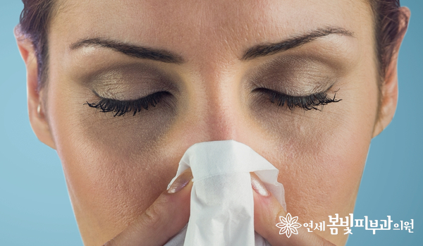 다크써클 없애는법 #2 (다크써클의 치료: 바르는 약, 미백크림, 미백크림효과) 관련 이미지 1