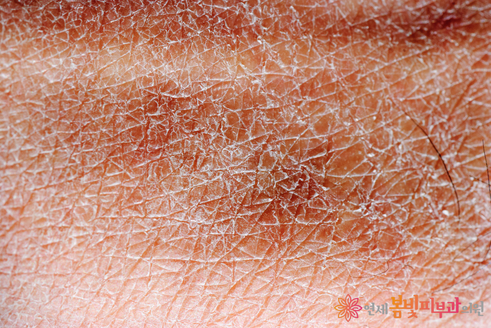 건조한 겨울철, 피부를 촉촉하고 건강하게 피부좋아지는 방법 (수분크림, 수분크림추천, 보습크림추천) 관련 이미지 1