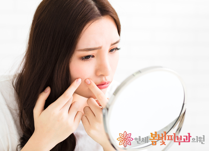 여드름 패치 안전하게 사용하기 관련 이미지 1