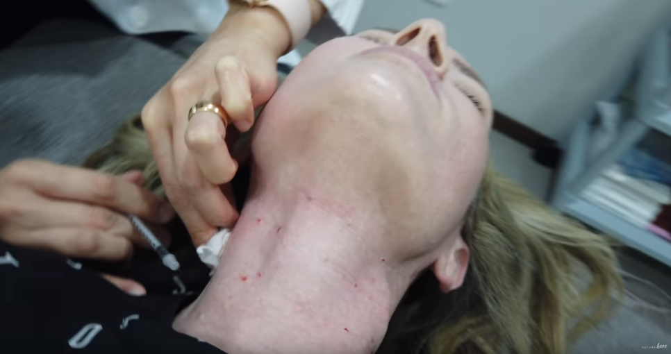 해외 뷰티 유투버 Natural Kaos 방문 및 시술 관련 이미지 12