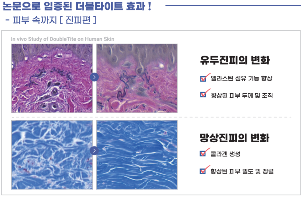 더블타이트 (Double Tite) 도입 안내 관련 이미지 10