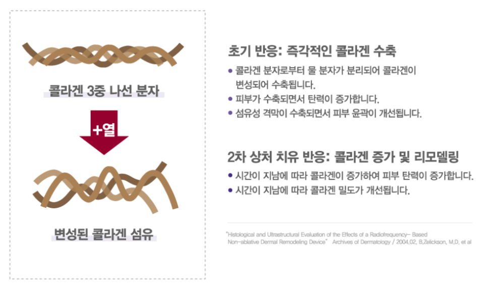 텐써마 (10 Therma) 도입 안내 관련 이미지 3