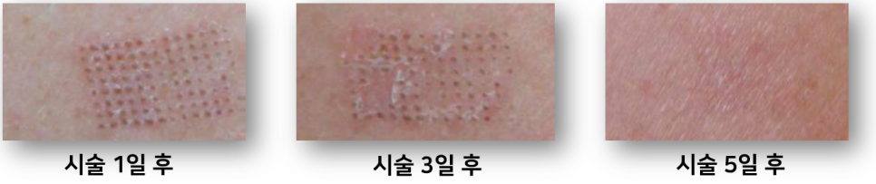 엔디메드 3DEEP Pure+ 2.0 도입 안내 관련 이미지 6