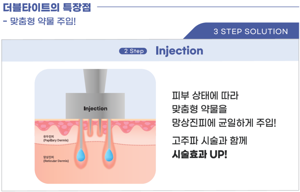 더블타이트 (Double Tite) 도입 안내 관련 이미지 6