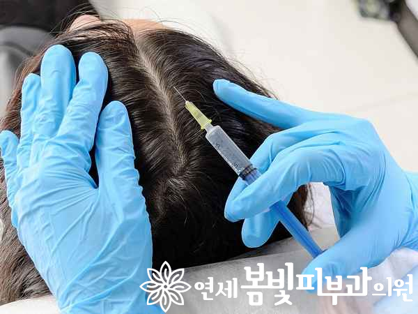 샴푸로 탈모가 좋아질까요? 관련 이미지 4