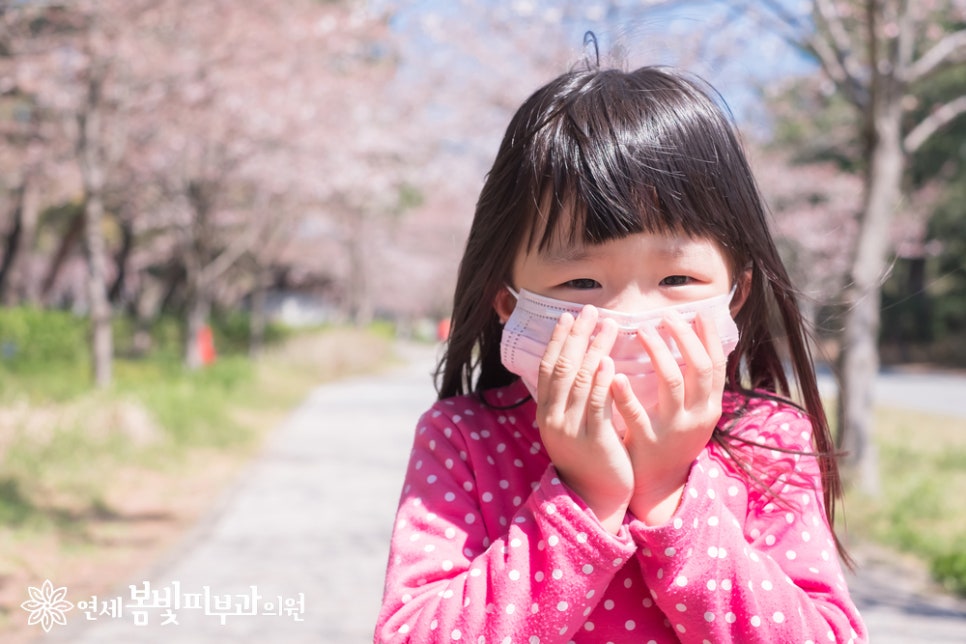 봄철에 발생하는 나무 꽃가루 알레르기 (알러지피부염, 아토피피부염, 천식) 관련 이미지 1