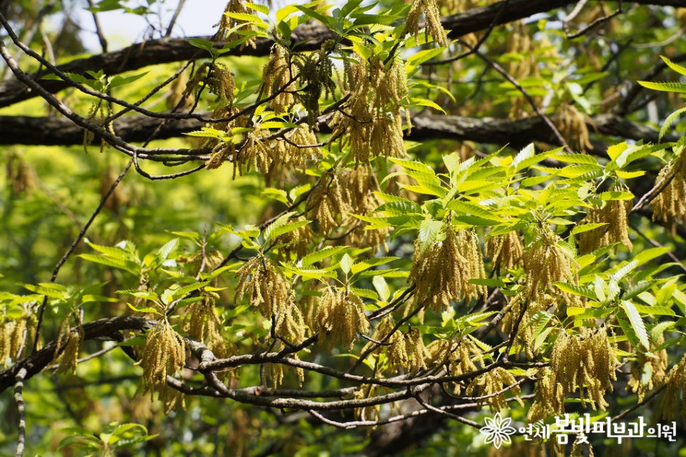 봄철에 발생하는 나무 꽃가루 알레르기 (알러지피부염, 아토피피부염, 천식) 관련 이미지 2