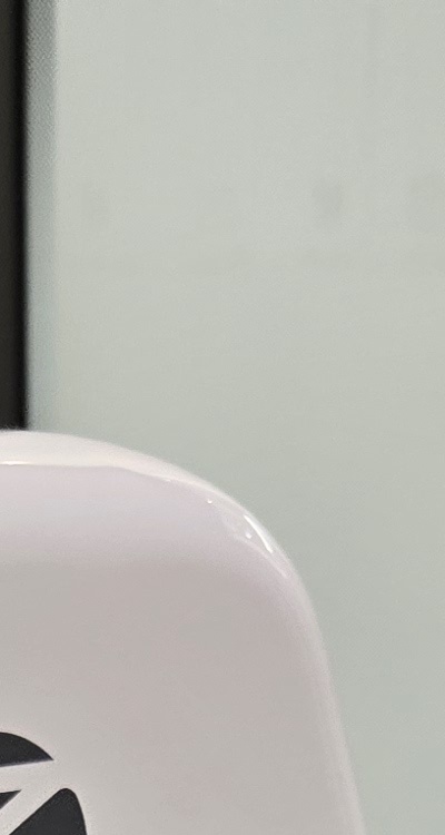 신경치료 아픈가요 망설이시는 분들이라면 관련 이미지 16