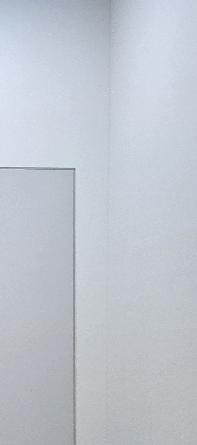 금 크라운 수명 몇년이나 지속될까요 관련 이미지 26