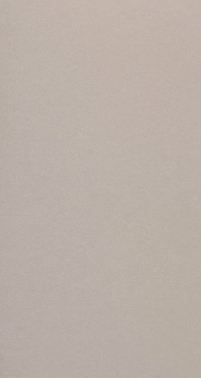 앞니 올세라믹 이건 알고 시작하세요 관련 이미지 20