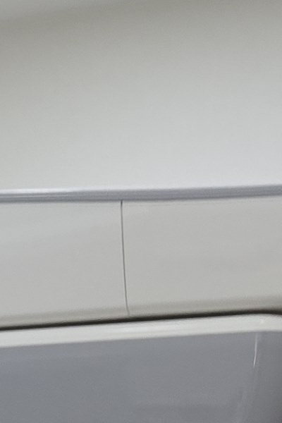 부정교합 교정 안하면 생기는 문제는 뭔가요 관련 이미지 25