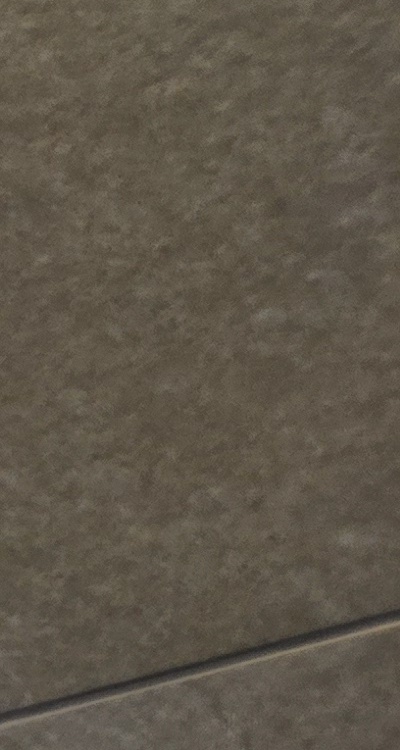 반대교합 치아교정 해결 가능할까 관련 이미지 27