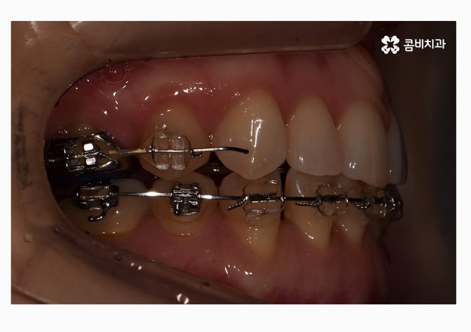 콤비교정 합리적으로 판단하려면 관련 이미지 14