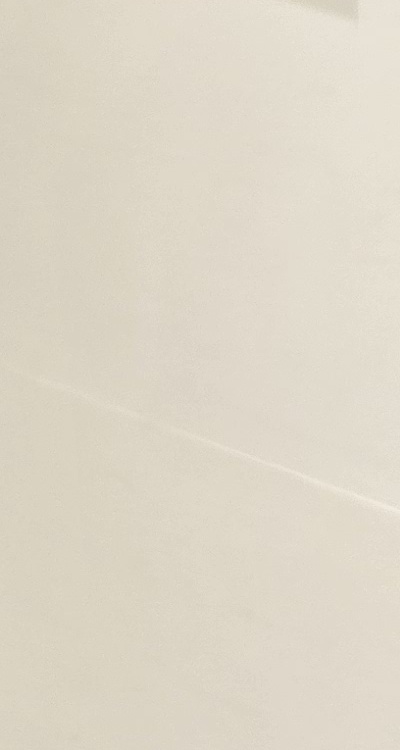 송곳니 크라운 티가 안나게 해결 가능한건가요 관련 이미지 32