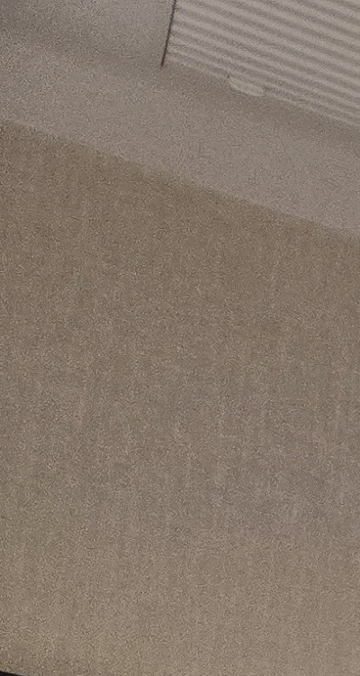 인레이 치료 후 통증 자꾸 심해지는데 괜찮은걸까 관련 이미지 12