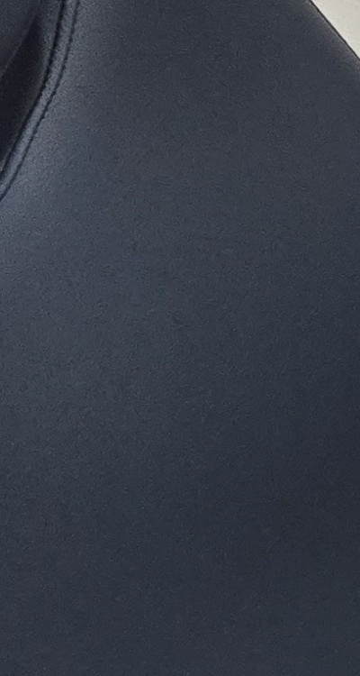 치아 사이 벌어짐 심해지는 이유부터 알아보면 관련 이미지 22