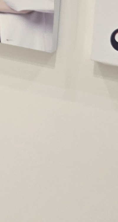 송곳니 크라운 티가 안나게 해결 가능한건가요 관련 이미지 36