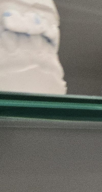 사랑니 주변 잇몸 통증 지금부터가 중요하니까 관련 이미지 24