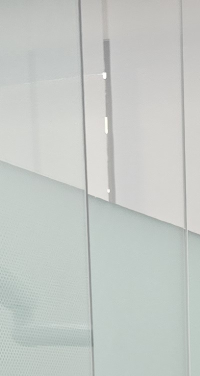 충치 검은점 나타났다면 이렇게 대처해요 관련 이미지 15