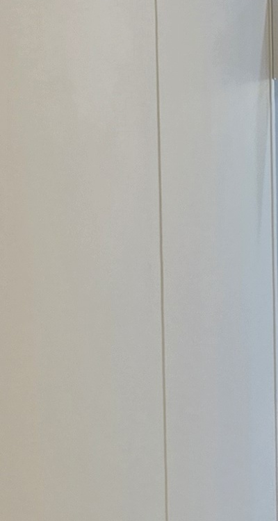 클리피씨교정 장단점 어떻게 비교하면 될까요 관련 이미지 23