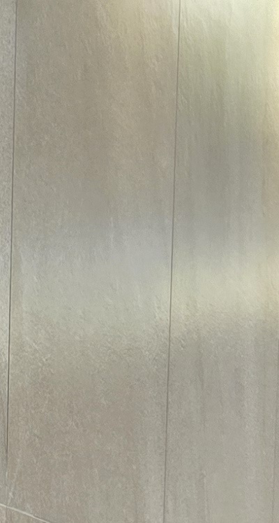 임플란트의 장점 할까 말까 고민이신 분들을 위한 정리 관련 이미지 16