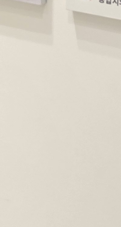 송곳니 크라운 티가 안나게 해결 가능한건가요 관련 이미지 34