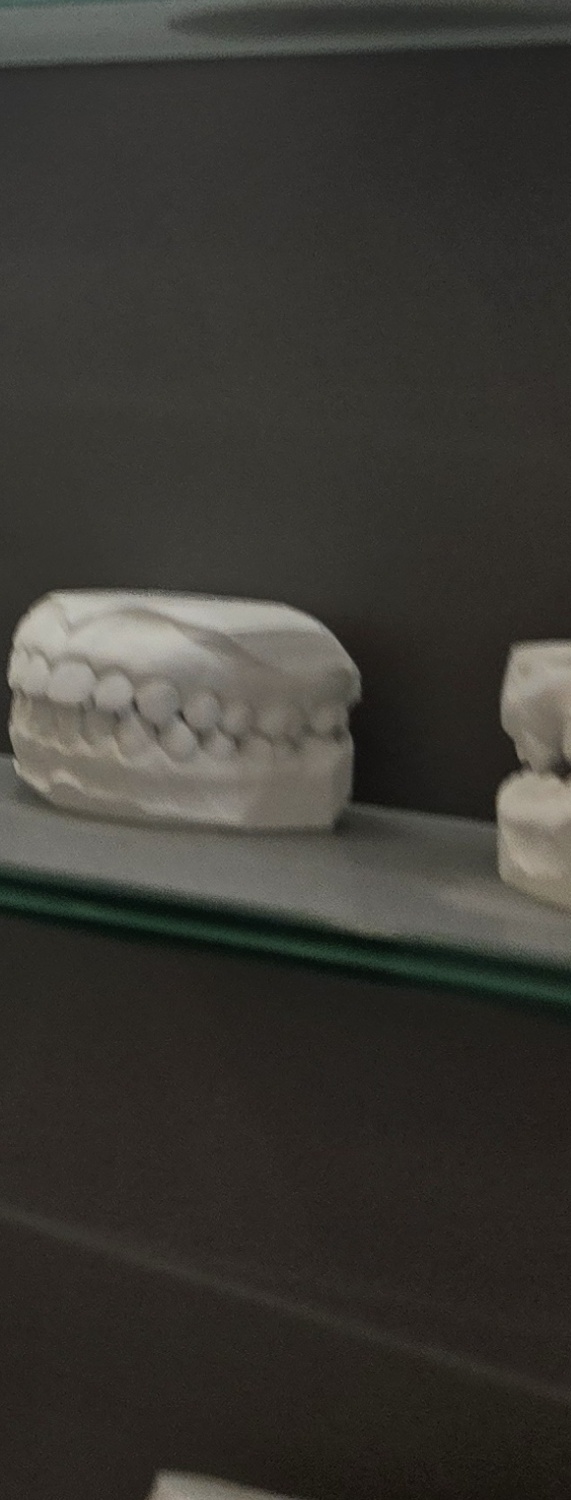 치과 치아미백 효과 어떤식으로 나타날까 관련 이미지 42