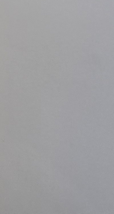 앞니 부분 교정 간단하니까 좋은건가요 관련 이미지 49