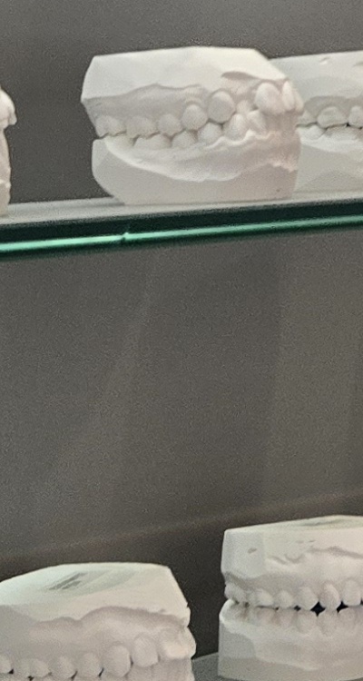 완전매복사랑니 발치 대학병원 꼭 가야하나요 관련 이미지 33