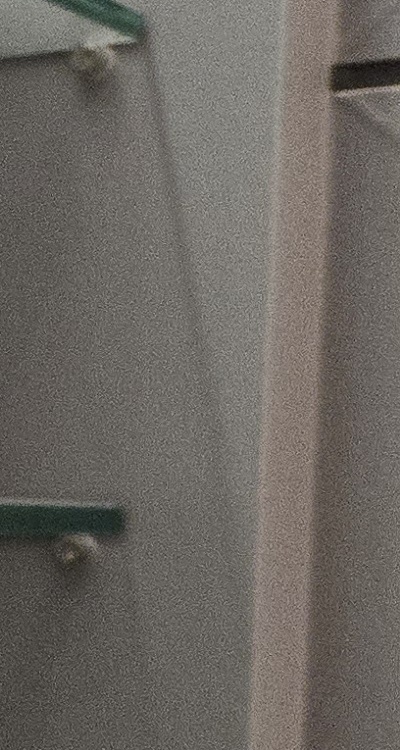 사랑니 주변 잇몸 통증 지금부터가 중요하니까 관련 이미지 31