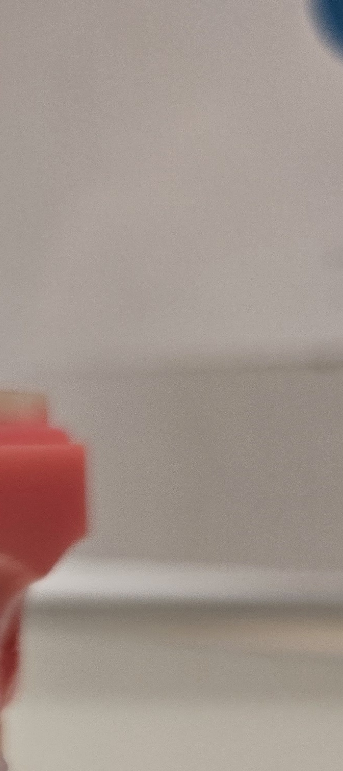 송곳니 덧니 발치 이럴때 해당되네요 관련 이미지 28