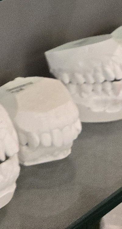 사랑니 주변 잇몸 통증 지금부터가 중요하니까 관련 이미지 48