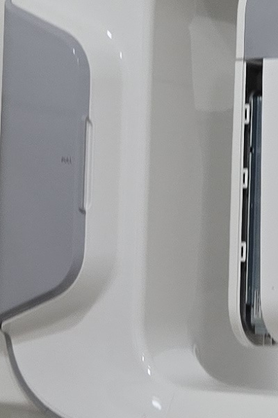 부정교합 교정 안하면 생기는 문제는 뭔가요 관련 이미지 33