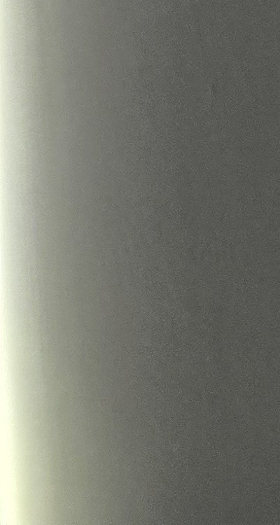 앞니 틀어짐 교정 조화롭게 마무리하려면 관련 이미지 39