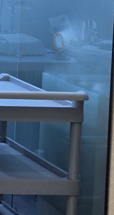 앞니 올세라믹 이건 알고 시작하세요 관련 이미지 38