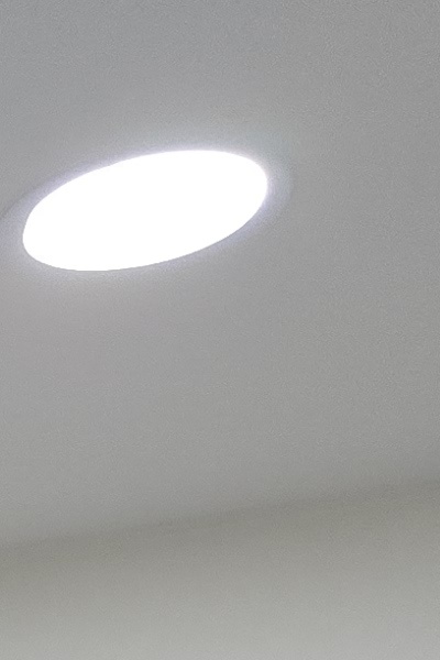 부정교합 교정 안하면 생기는 문제는 뭔가요 관련 이미지 17