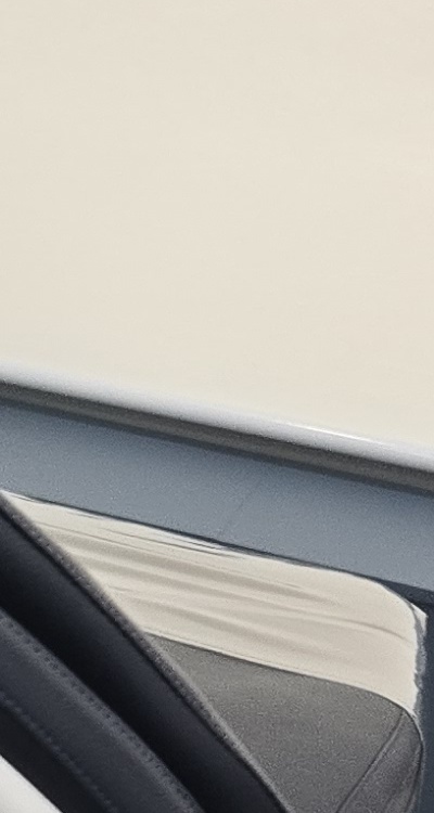 어금니 임플란트 안하면 후회하게 되는걸까 관련 이미지 30